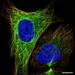 Microtubules structure function biology definition